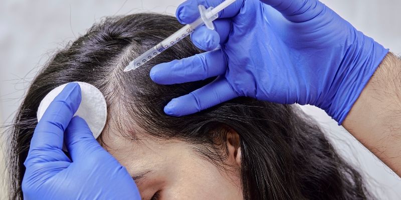 عوارض مزوتراپی مو چیست