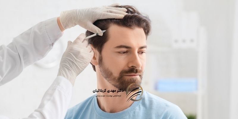 مدت زمان کاشت مو