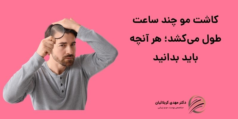 کاشت مو چند ساعت طول می‌کشد