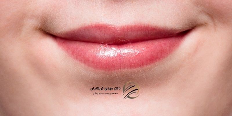خشکی لب نشانه چیست