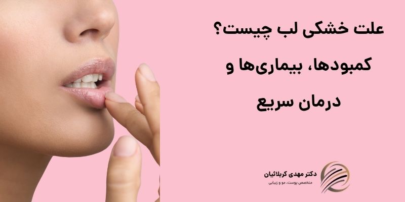 علت خشکی لب چیست