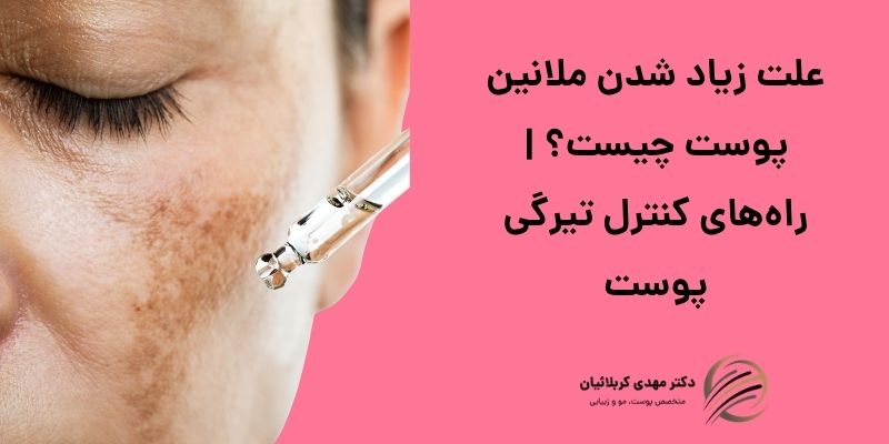 علت زیاد شدن ملانین پوست