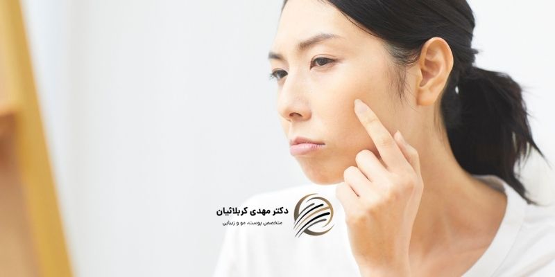 چگونه می‌توان به کاهش ملانین پوست کمک کرد؟