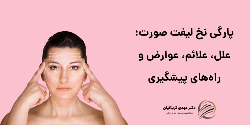 پارگی نخ لیفت صورت